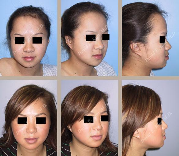 Beverly Hills Plastic Surgery gallery image 9