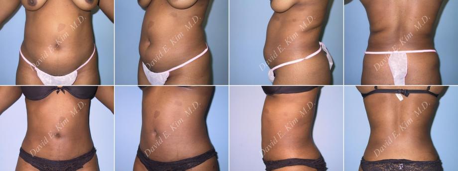 Beverly Hills Plastic Surgery gallery image 10