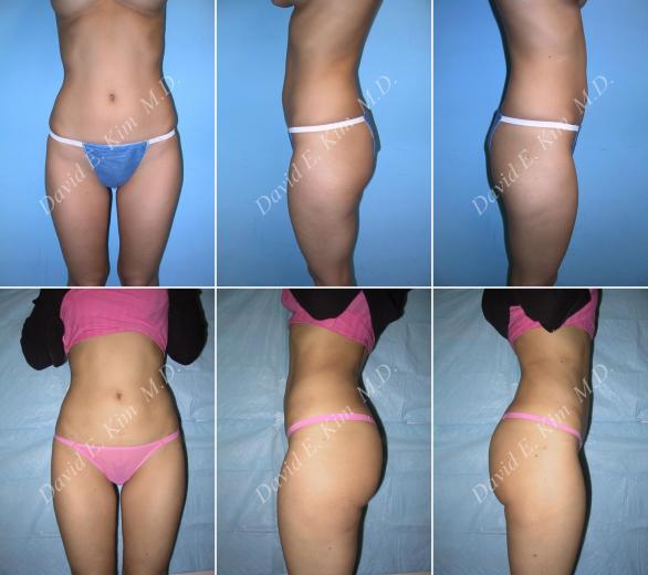 Beverly Hills Plastic Surgery gallery image 11