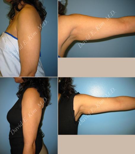 Beverly Hills Plastic Surgery gallery image 12
