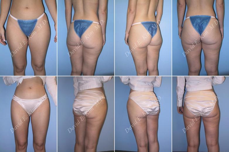 Beverly Hills Plastic Surgery gallery image 13