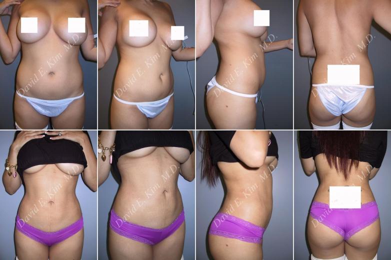 Beverly Hills Plastic Surgery gallery image 14