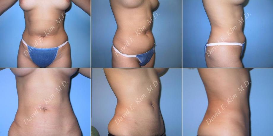 Beverly Hills Plastic Surgery gallery image 15