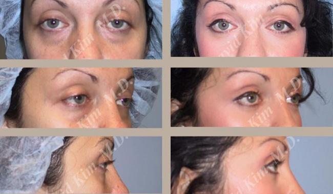 Beverly Hills Plastic Surgery gallery image 17