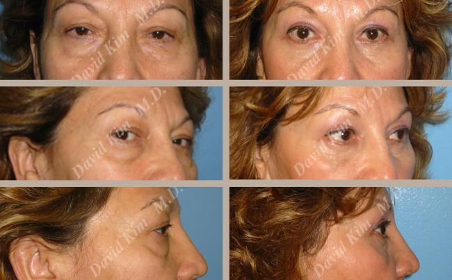 Beverly Hills Plastic Surgery gallery image 18