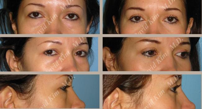 Beverly Hills Plastic Surgery gallery image 19