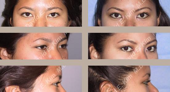 Beverly Hills Plastic Surgery gallery image 20