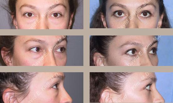 Beverly Hills Plastic Surgery gallery image 21