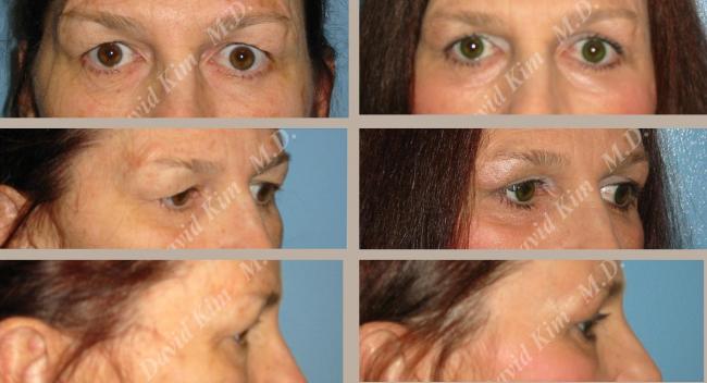 Beverly Hills Plastic Surgery gallery image 22