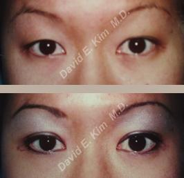 Beverly Hills Plastic Surgery gallery image 23