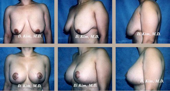 Beverly Hills Plastic Surgery gallery image 24