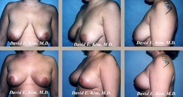 Beverly Hills Plastic Surgery gallery image 26