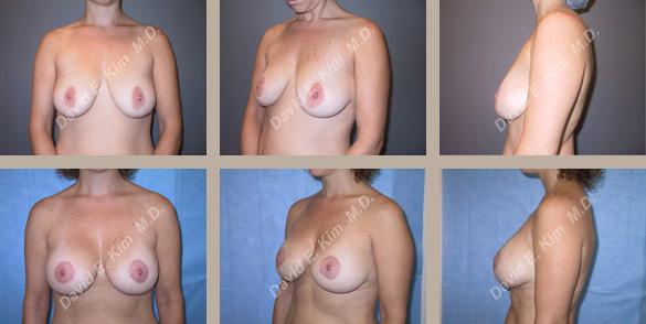 Beverly Hills Plastic Surgery gallery image 27