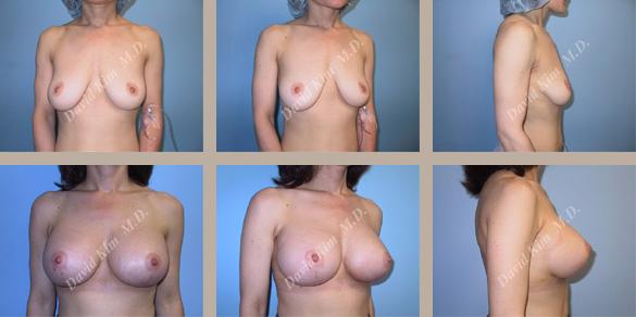 Beverly Hills Plastic Surgery gallery image 28