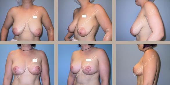 Beverly Hills Plastic Surgery gallery image 31