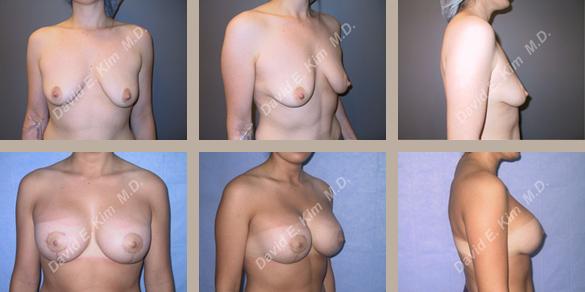 Beverly Hills Plastic Surgery gallery image 32