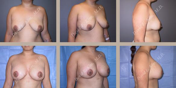Beverly Hills Plastic Surgery gallery image 34