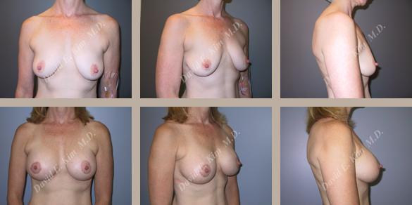 Beverly Hills Plastic Surgery gallery image 37