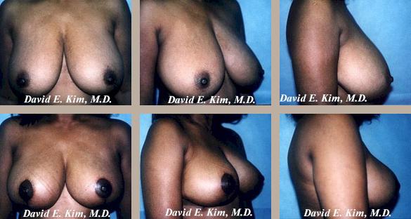 Beverly Hills Plastic Surgery gallery image 38