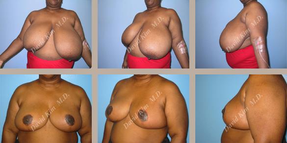 Beverly Hills Plastic Surgery gallery image 39