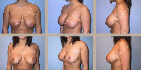 Beverly Hills Plastic Surgery gallery image 40