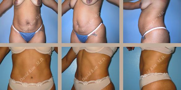 Beverly Hills Plastic Surgery gallery image 44