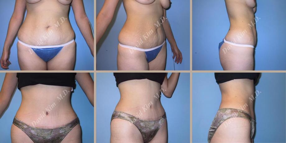Beverly Hills Plastic Surgery gallery image 45