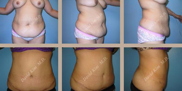 Beverly Hills Plastic Surgery gallery image 46
