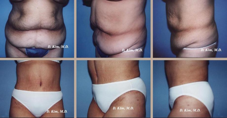 Beverly Hills Plastic Surgery gallery image 47