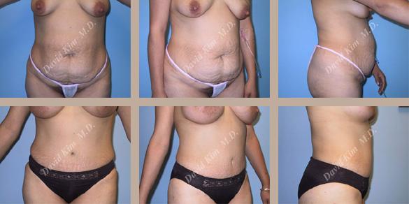 Beverly Hills Plastic Surgery gallery image 48