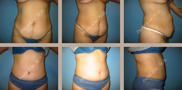 Beverly Hills Plastic Surgery gallery image 49