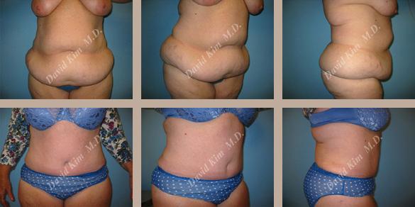 Beverly Hills Plastic Surgery gallery image 50