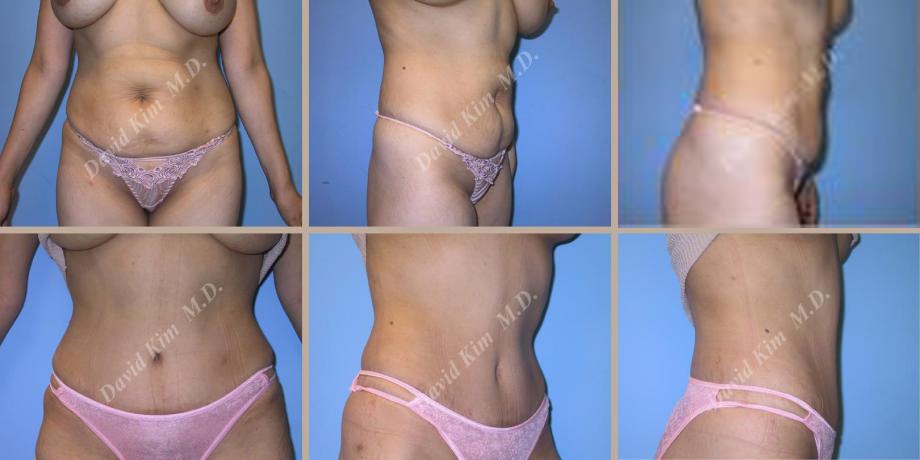 Beverly Hills Plastic Surgery gallery image 51