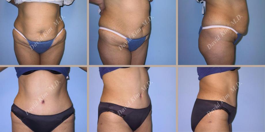 Beverly Hills Plastic Surgery gallery image 52