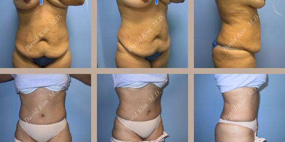 Beverly Hills Plastic Surgery gallery image 53