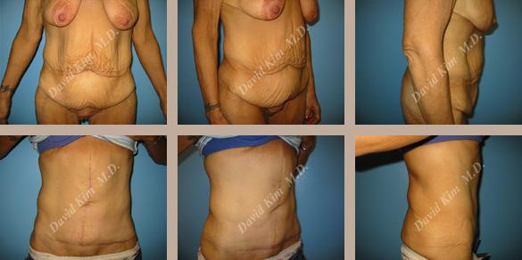 Beverly Hills Plastic Surgery gallery image 54