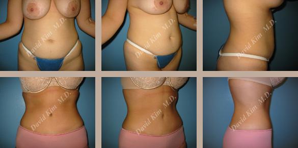 Beverly Hills Plastic Surgery gallery image 55