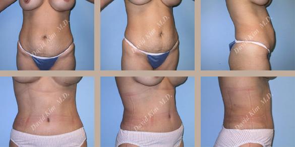 Beverly Hills Plastic Surgery gallery image 56