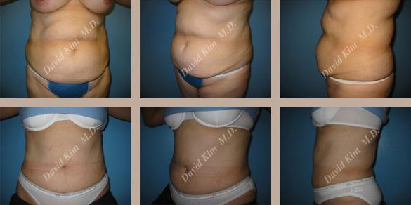 Beverly Hills Plastic Surgery gallery image 57