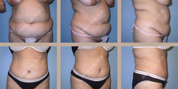 Beverly Hills Plastic Surgery gallery image 58