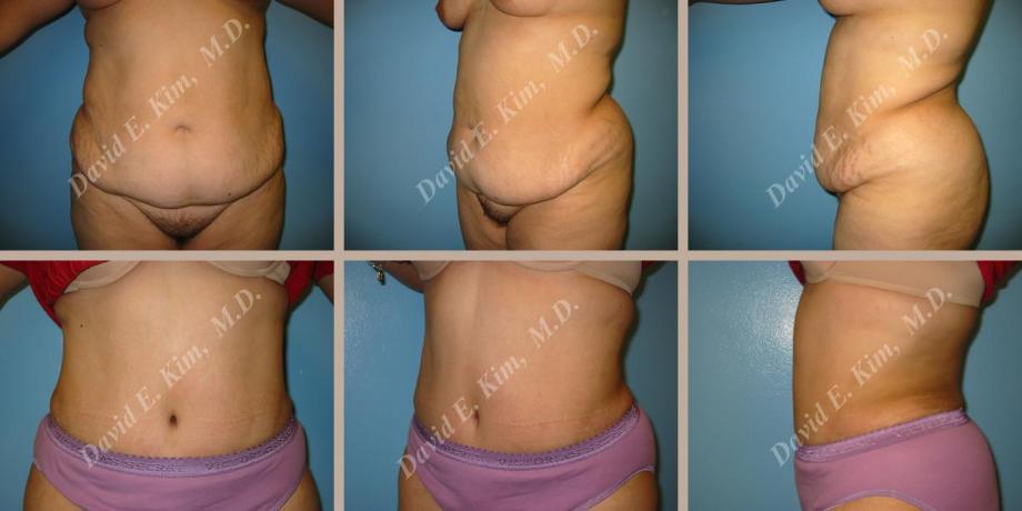Beverly Hills Plastic Surgery gallery image 59