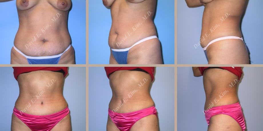 Beverly Hills Plastic Surgery gallery image 60