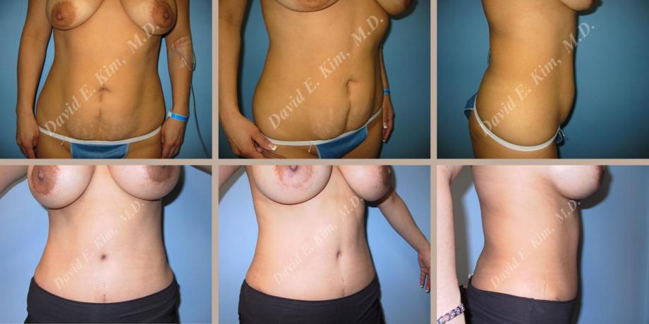 Beverly Hills Plastic Surgery gallery image 61