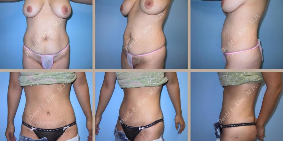 Beverly Hills Plastic Surgery gallery image 62