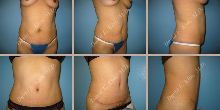 Beverly Hills Plastic Surgery gallery image 63