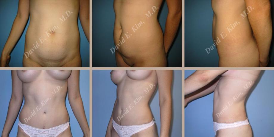 Beverly Hills Plastic Surgery gallery image 64