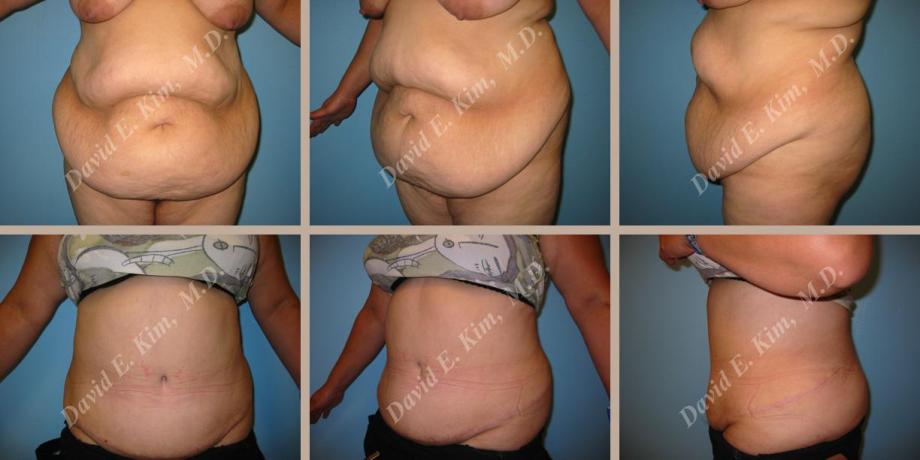 Beverly Hills Plastic Surgery gallery image 65