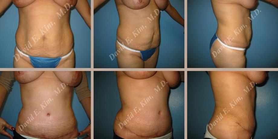 Beverly Hills Plastic Surgery gallery image 66