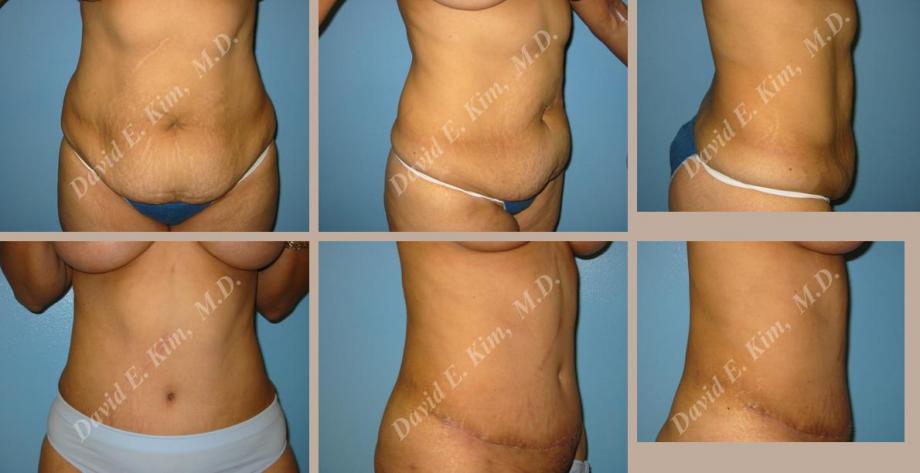 Beverly Hills Plastic Surgery gallery image 67