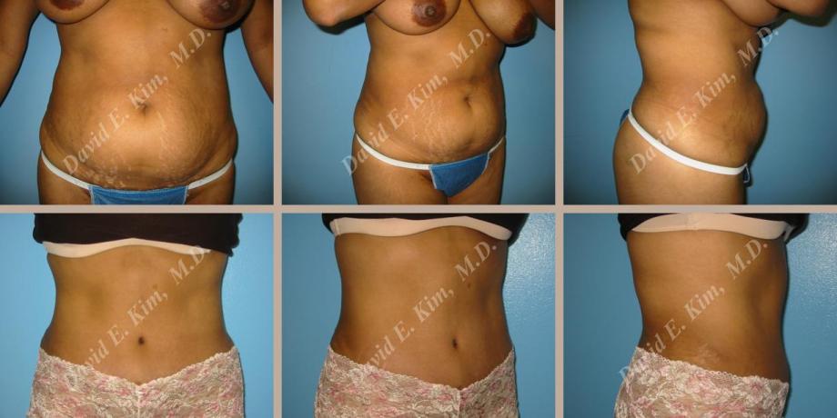 Beverly Hills Plastic Surgery gallery image 68